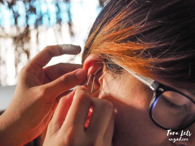 Tree of Life Wellness Center - ear acupuncture